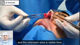 رفع سه مشکل اساسی بینی در یک عمل جراحی