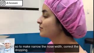 از آمریکا برای خوشگل شدن بینی اش آمده. به نظرتان قشنگ شد؟