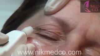 آموزش کار با پلکسر