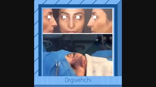 عمل جراحی زیبایی بینی