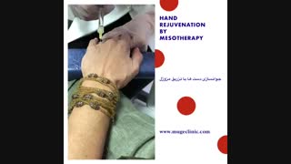 جوانسازی دست با تزرق مزوژل