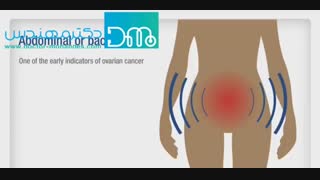 مهم ترین علائم سرطان تخمدان