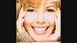 مراحل چسباندن لمینیت دندان | تفاوت کامپوزیت دندان با لمینیت دندان | قیمت لمینیت سرامیکی سال 98 | لمینیت سرامیکی چیست