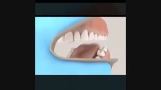 فیلم روکش دندان