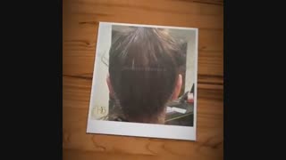 جراحی زیبایی گوش