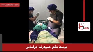 کاشت ابرو | فیلم کاشت ابرو | کلینیک پوست و مو هلیا | شماره 27