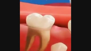 فیلم کشیدن دندان شیری