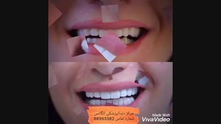 بهترین دندانپزشک زیبایی مرکز تهران | بهترین متخصص اندو مرکز تهران | بهترین متخصص اندو میدان ولیعصر