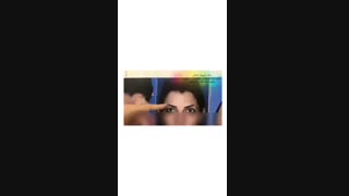 لیفت اندوسکوپی پیشانی و اندوتاین