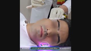 بوتاکس  دور چشم - 02632402304