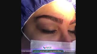 کاشت ابرو - 02632402304