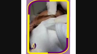 لیفت ابرو با نخ