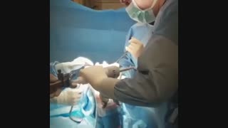 عملیه استبدال مفصل الرکبه