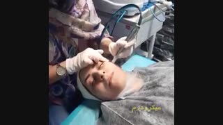 جوانسازی پوست در کلینیک آریامن | میکرودرمینگ | نخ لیفت