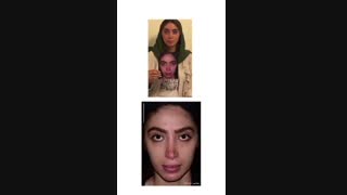 فیلم جراحی بینی
