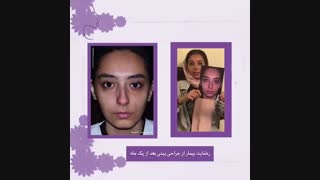 نمونه کار جراحی بینی