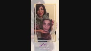 عمل بینی دکتر ماریا مرادی