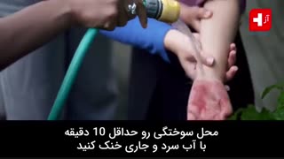 در 1 دقیقه کمک های اولیه سوختگی را یاد بگیرید!