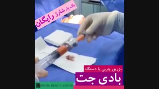 تزریق چربی با دستگاه بادی جت