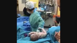 زایمان طبیعی بدون برش اپی زیوتومی