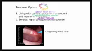 مرکز آسیب شناسی گفتاروزبان09121623463 | تهران جنت آباد فرعی هجرت