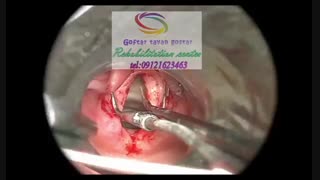 گفتاردرمانی تخصصی کودک 09121623463 | تهران باغ فیض فرعی سفید