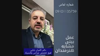 جراحی بینی شبیه به هنرمندان