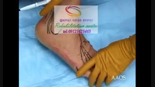 مرکز کاردرمانی جسمی بزرگسالان 09121623463 | تهران بزرگراه کاشانی فرعی محمود