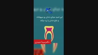کدام مواد غذایی باعث زردی دندان می شود؟