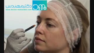 چه عواملی باعث پف زیر چشم می شود