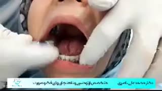 ارتودنسی تک فک