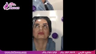 عمل بینی توسط دکتر کاوان