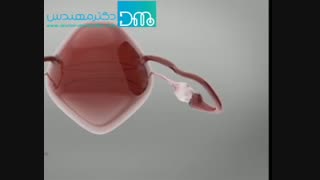 کیست تخمدان چیست