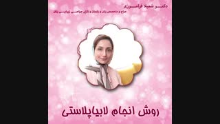 صحبت های دکتر فرامرزی درباره لابیاپلاستی بخش2 پلاسماجت