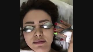 اجاره لیزر الکساندرایت کلاریتی