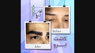 فیلم کاشت ابرو در کلینیک کاشت مو و زیبایی آریامن 02142485000