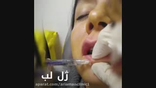 انجام کلیه خدمات زیبایی در کلینیک زیبایی آریامن 02142485000