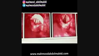 صداسازی - آموزش آواز - نوحه خوانی یکی از هنرجویان کلاس آنلاین صداسازی - آموزش نوحه - آموزش مداحی - صدای میکس