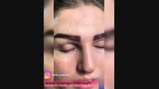 فیلم  نمونه  کاشت ابرو و نتیجه آن | کلینیک آریامن 02141608