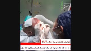 فیلم کاشت مو SUT | کلینیک کاشت مو و زیبایی آریامن کلینیک مو