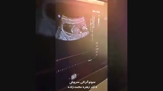 شنیدن صدای قلب جنین در سونوگرافی