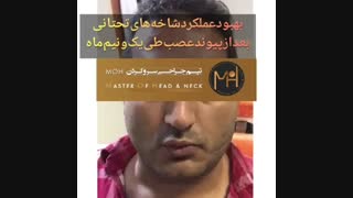 جراحی پیوند عصب