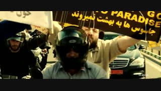 بادی گارد - ابراهیم حاتمی کیا لیفت گردنایمپلنت دندان