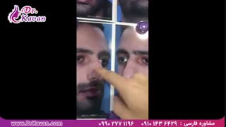 جراحی زیبایی بینی