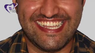 اظهار نظر یکی دیگر از مراجعین عزیز کلینیک ما | دکتر فاضل فیروزی