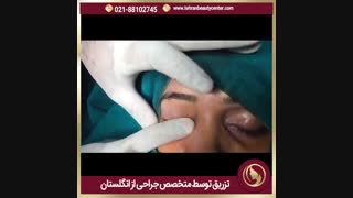 تزریق چربی در مرکز زیبایی تهران