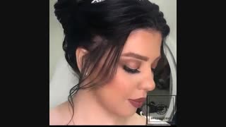 قبل و بعد عروس