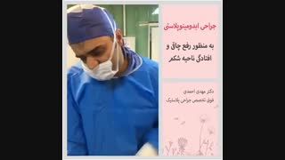 جراحی ابدومینوپلاستی (جراحی لاغری شکم)