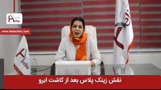 نقش زینک پلاس بعد از کاشت ابرو طبیعی | کلینیک هلیا | 02122810089