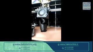 ساخت کفی و سوکت پروتز زیر زانو با پرینتر سه بعدی